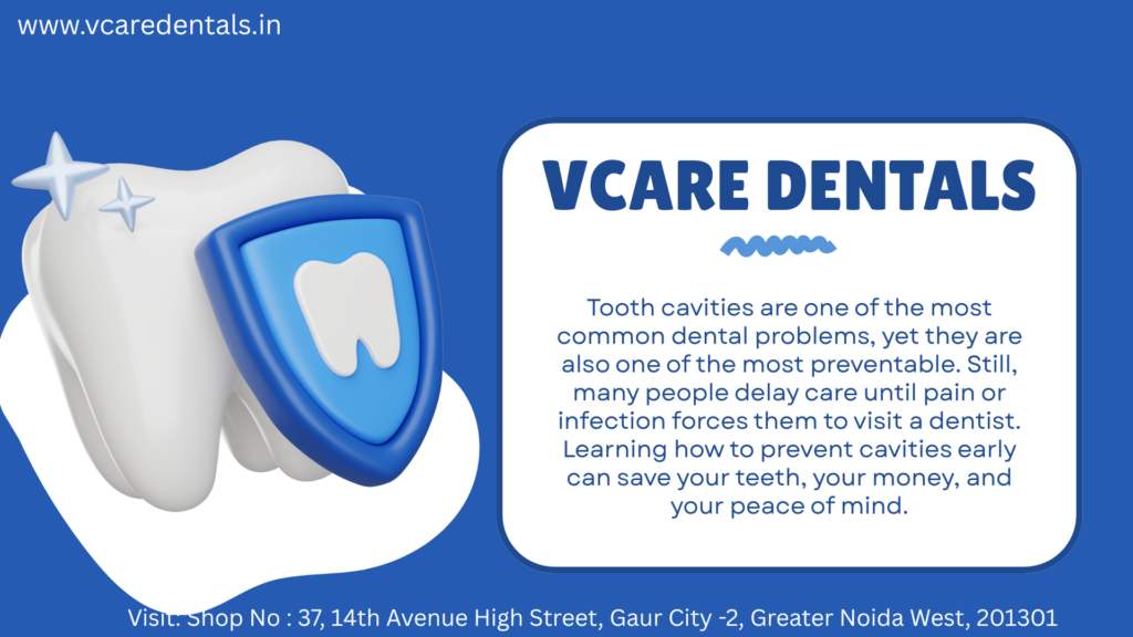 How to Prevent Cavities